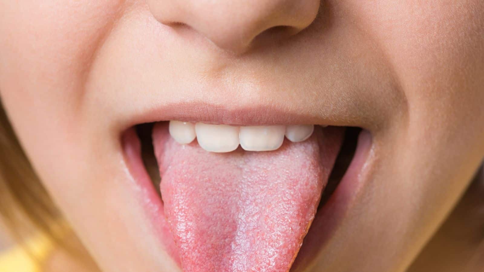 A close-up of a person’s open mouth with their tongue sticking out, showing white coating and visible taste buds on the tongue’s surface. The teeth and lips are also visible.